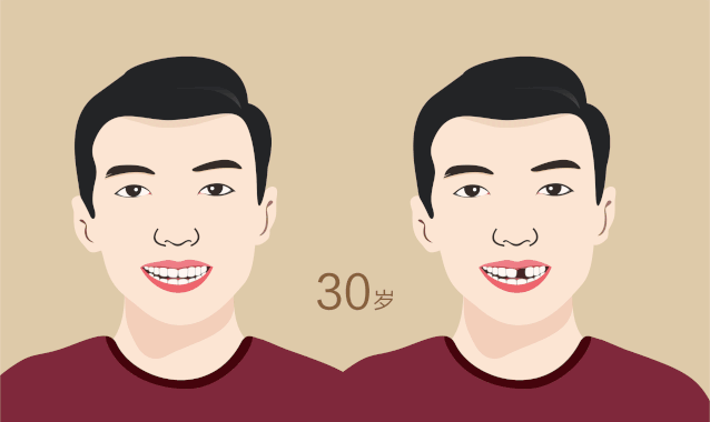 坦白局:剖判缺牙不补可以吗,会有什么影响 坦白局:剖判缺牙不补可以吗,会有什么影响