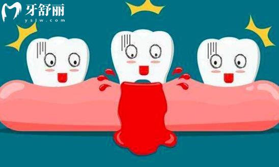 熬夜不仅会有黑眼圈和秃头,竟然对牙齿还有伤害? 熬夜不仅会有黑眼圈和秃头,竟然对牙齿还有伤害?