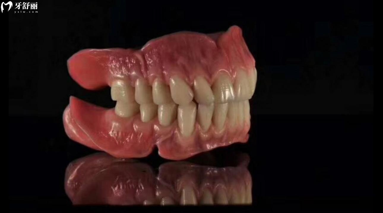 吸附性义齿有几种型号?吸附性义齿能使用多少年?