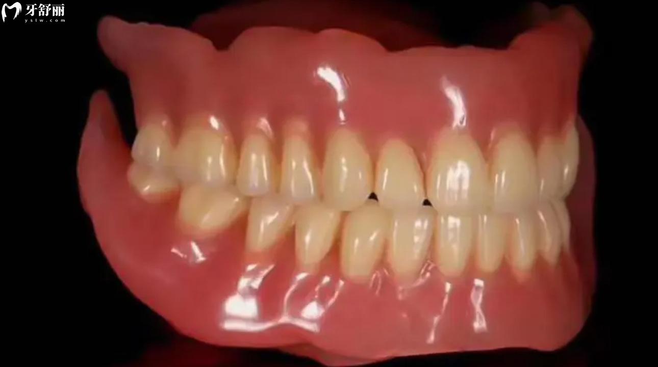 吸附性义齿有几种型号?吸附性义齿能使用多少年?