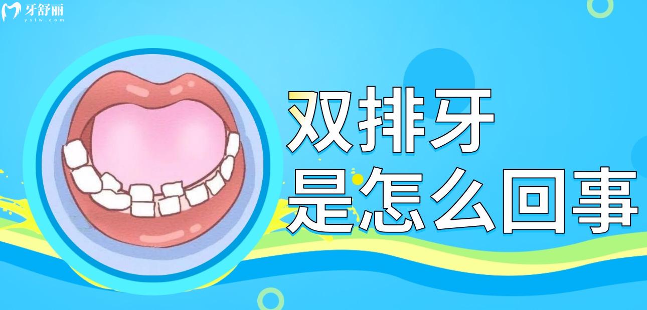 儿童双排牙拔掉后会自动归位吗？出现双排牙是怎么回事