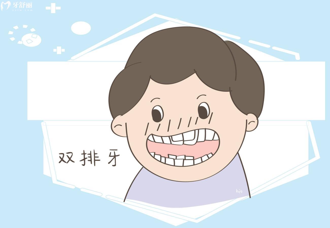 儿童双排牙拔掉后会自动归位吗？出现双排牙是怎么回事
