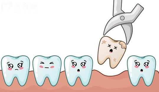 上海拔智齿能用社保的牙科盘点  拔牙技术好还不疼