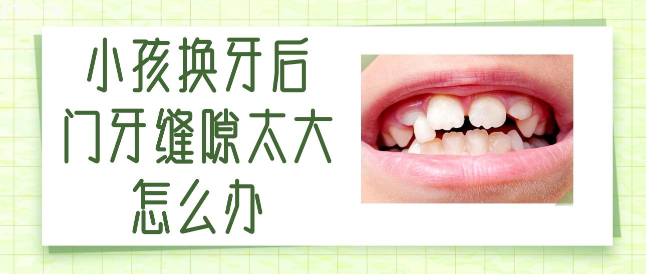 小孩换牙后门牙缝隙太大怎么办?一般都是什么原因引起的 小孩换牙后门牙缝隙太大怎么办?一般都是什么原因引起的