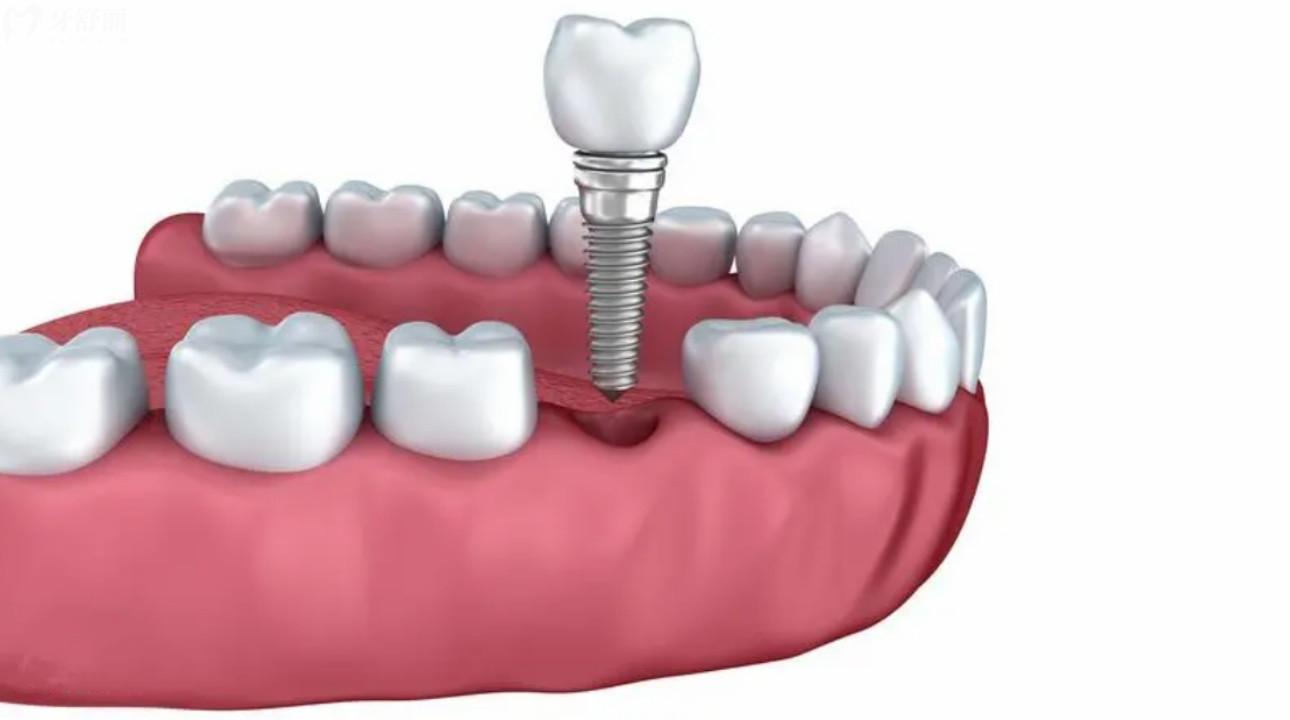 六盘水口腔医院哪家好?2023六盘水口腔医院排名一览表 六盘水口腔医院哪家好?2023六盘水口腔医院排名一览表