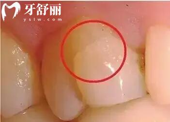 自己的牙齿好不好 ?对比完牙齿健康九大标准看你符合吗 自己的牙齿好不好 ?对比完牙齿健康九大标准看你符合吗