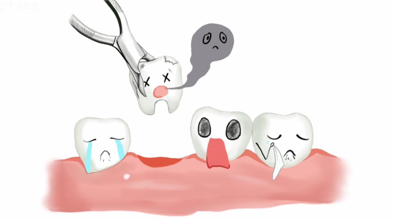 牙断了能保留牙根吗?牙齿断了一半修复价格? 牙断了能保留牙根吗?牙齿断了一半修复价格?