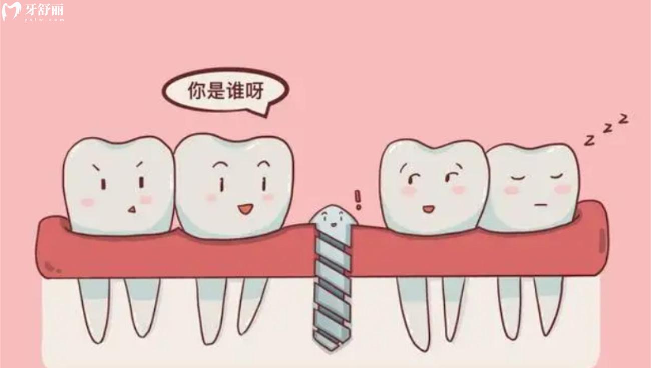 后牙种植与前牙种植有什么区别.jpg