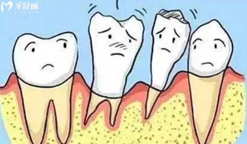 如何预防牙周病