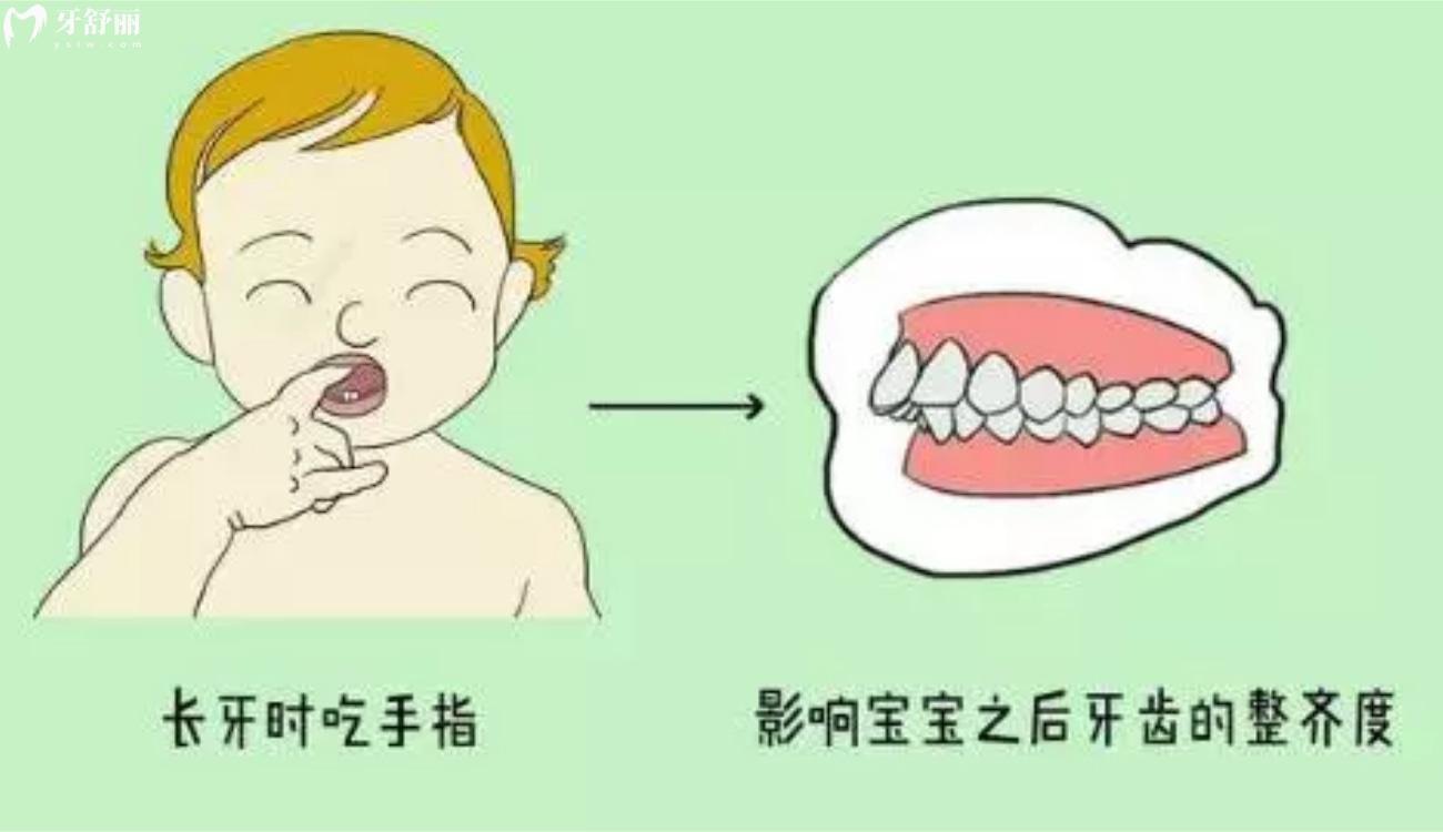 畸形儿牙的早期预防.jpg