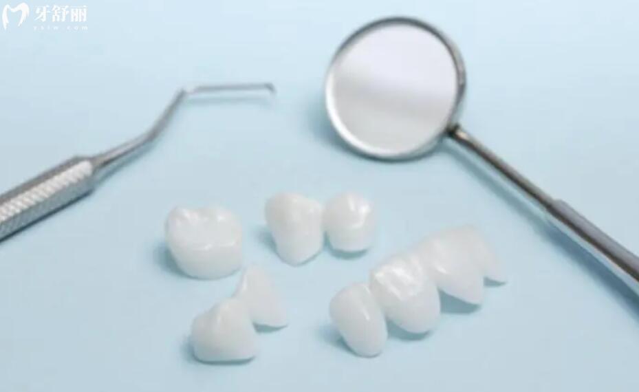 牙体缺损粘接修复术是什么意思