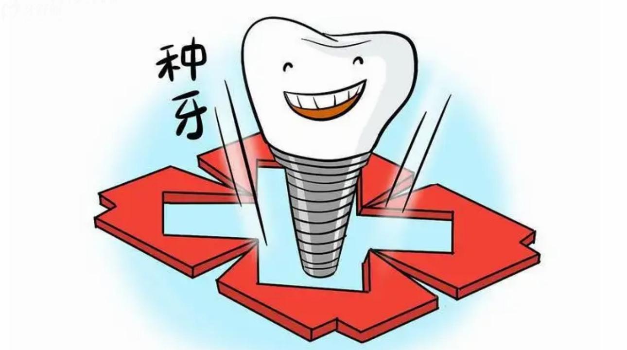 国内排名前十的种植牙口腔医院有哪些 上海/长沙/青岛奉上