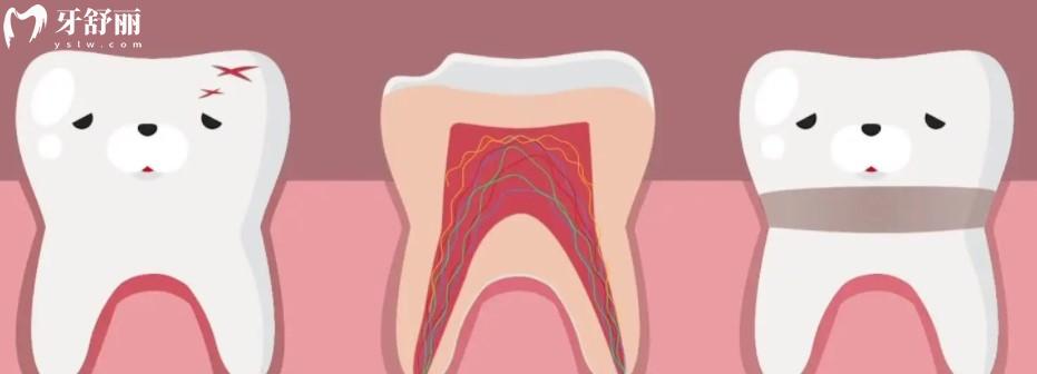 儿童根管治疗会影响换牙吗，小孩根管治疗能忍受吗
