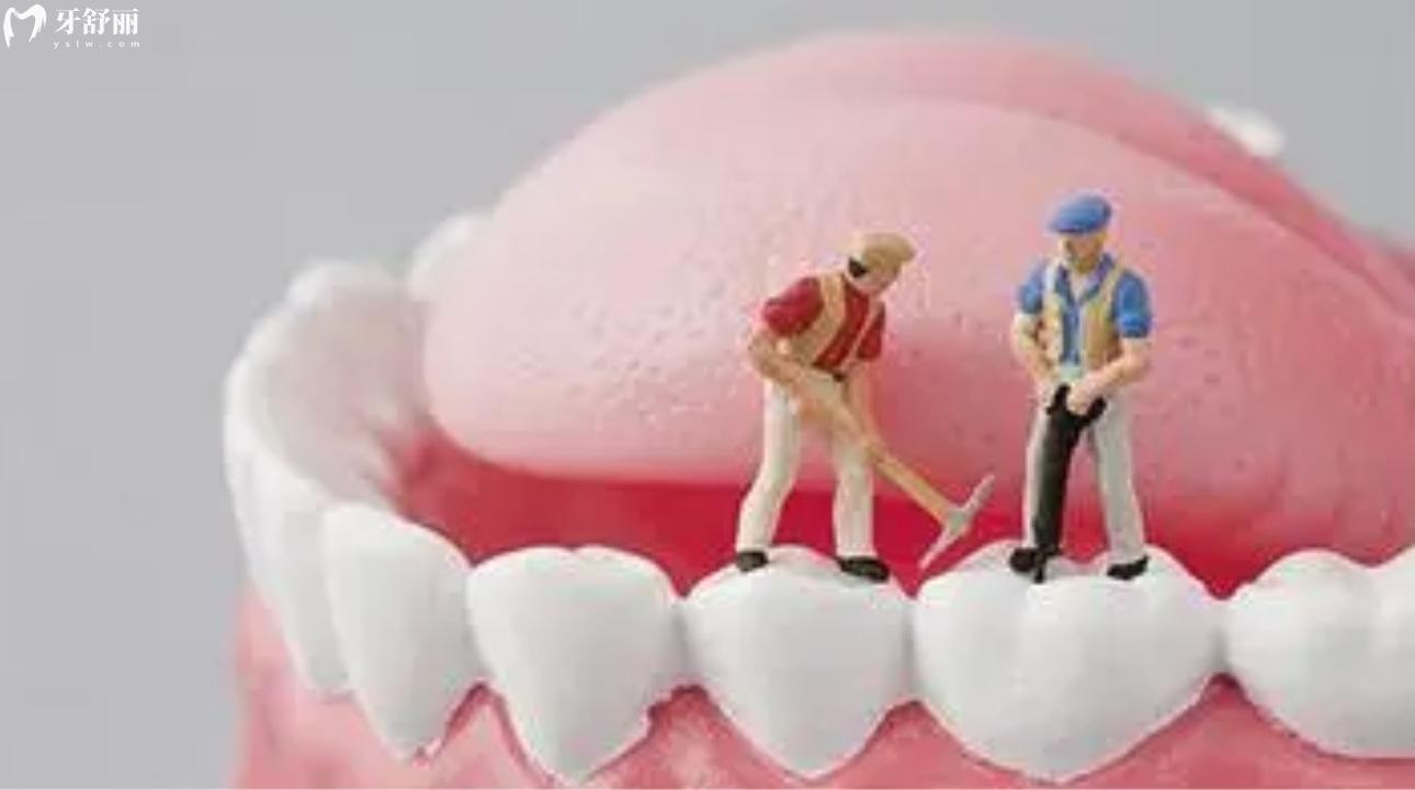 日本富士IX补牙材料和树脂补牙哪个好?维持年限是多久?