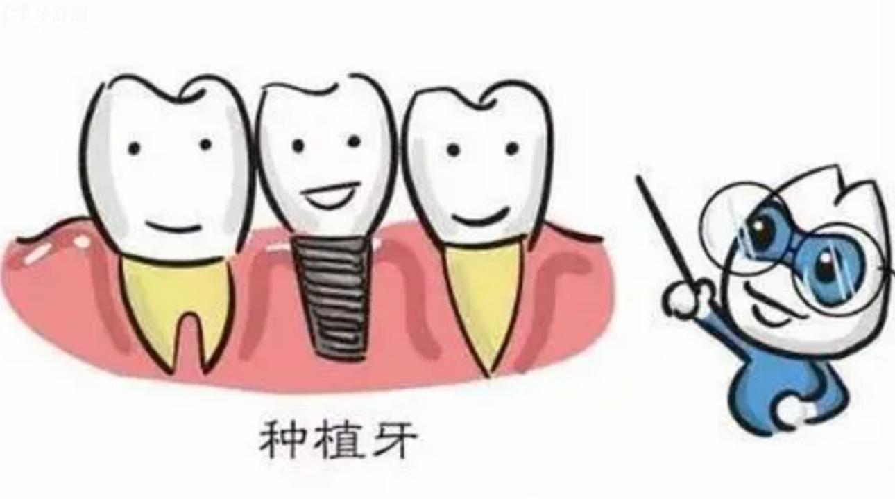 镶牙齿和种植牙齿哪个好一点 种植治疗的方式有哪些?