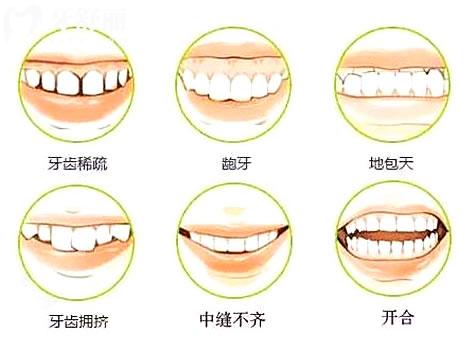 上海长宁区口腔医院牙齿矫正