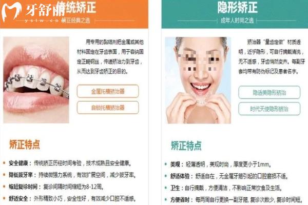 金属矫正和隐形矫正对比优势
