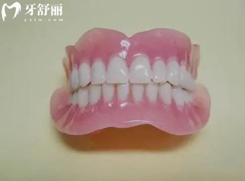 BPS吸附性假牙
