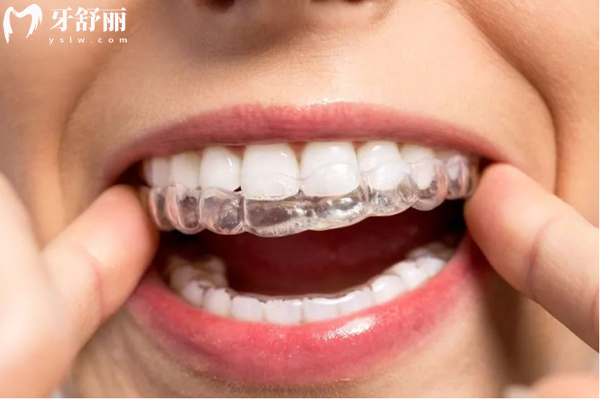 透明保持器3图