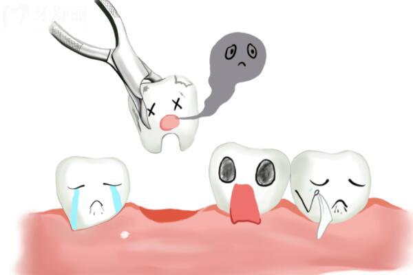 拔牙后疼痛怎么改善