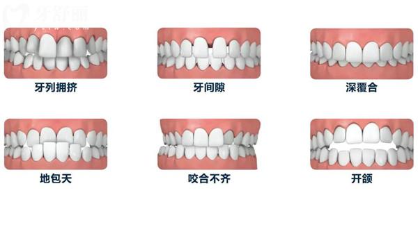 上海浦东新区口腔收费标准表更新,牙科常见项目报价不花冤枉钱