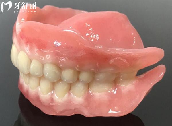 全口缺失牙齿怎么办?全口牙常见的修复方法有这三种