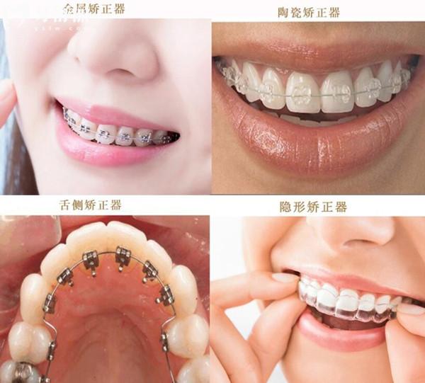 新版青岛口腔医院牙科收费价目表曝光,一览种牙/烤瓷牙/矫正多少钱