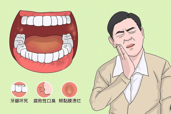 口腔内壁发炎怎么处理