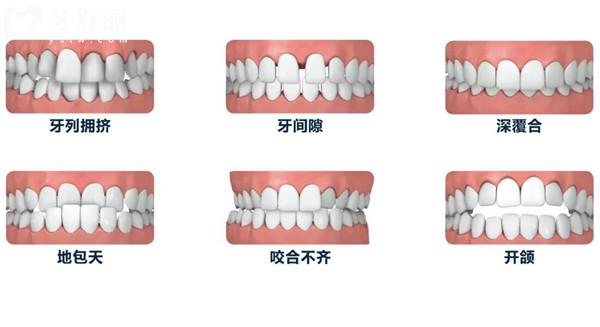 扬州口腔医院收费标准有调整,现在种植牙/牙齿矫正价格已下降