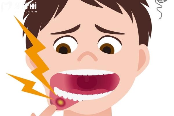 口腔粘膜炎症能自愈吗？