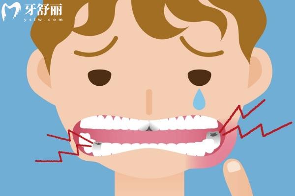 口腔粘膜炎症能自愈吗？