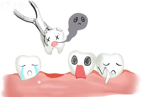 安顺牙科医院拔牙价格表