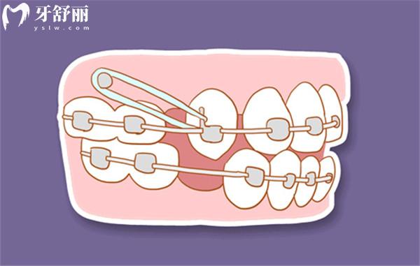 昆明口腔医院收费贵吗