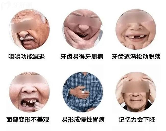 老年人缺牙不补的危害