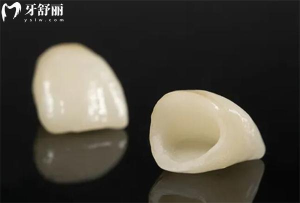 门牙做牙冠对生活会有影响吗？