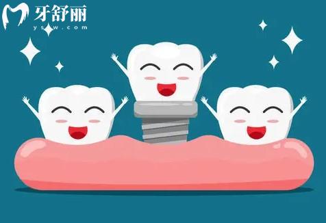 武汉种植牙多少钱一颗2023年