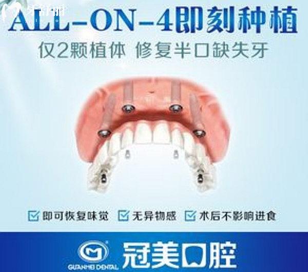 北京冠美口腔all-on-4种植手术