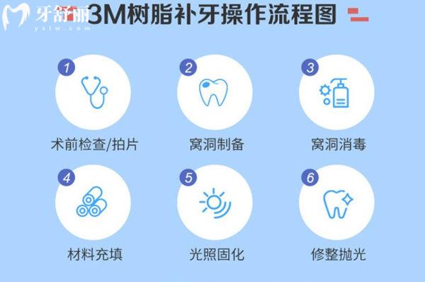 北京协和口腔补牙流程图