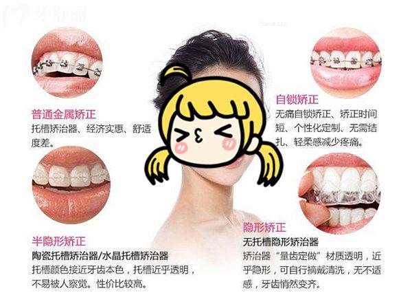 北京协和口腔牙齿矫正