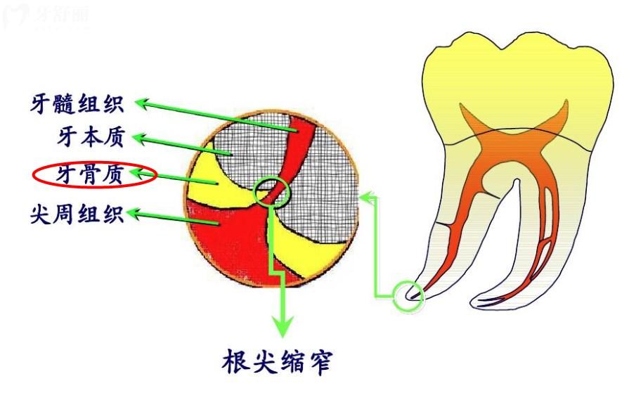 牙骨质具体位置示意图
