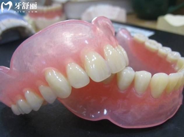 吸附性活动假牙
