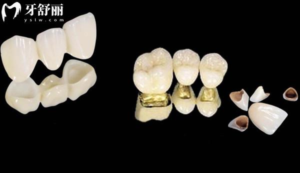 佛山登特口腔收费一览表2023,集采种植牙1380+牙齿矫正4999+