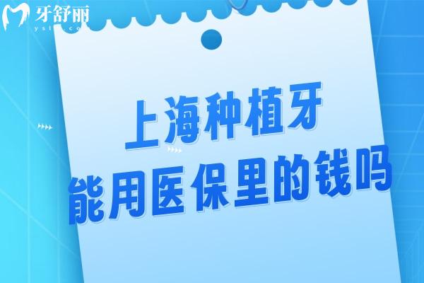 上海种植牙能用医 保里的钱吗