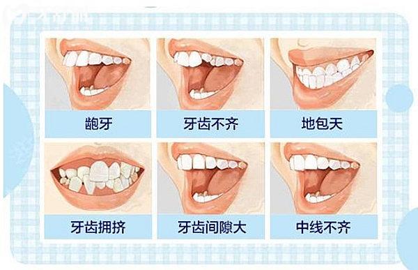 秦皇岛第 一医院口腔科整牙价格表