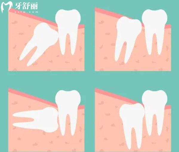 秦皇岛第 一医院口腔科拔牙价格表