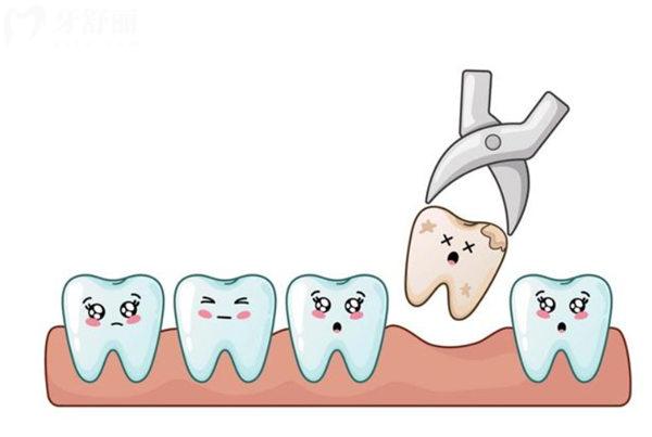 秦皇岛中医院牙科拔牙多少钱一颗