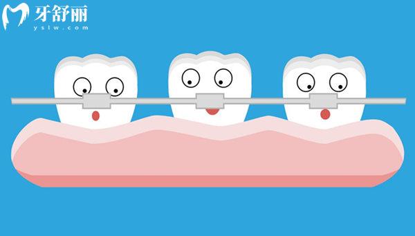 秦皇岛中医院牙科牙齿矫正收费标准