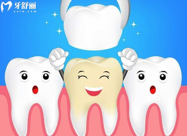 卡塔纳全瓷牙是哪国的?是日本的质量好硬度高属于中等档次价格3000起