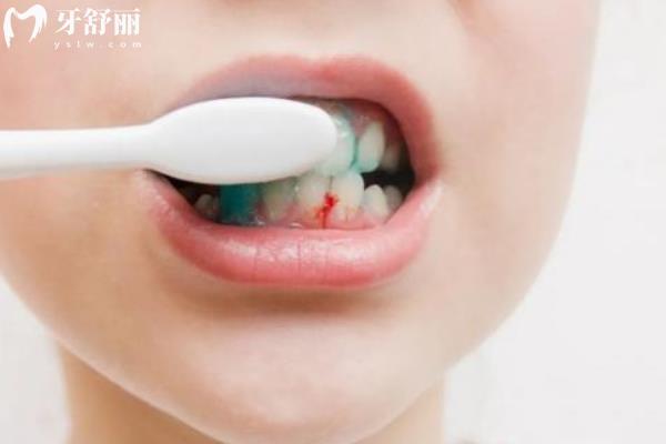 牙龈正常状态下是什么颜色