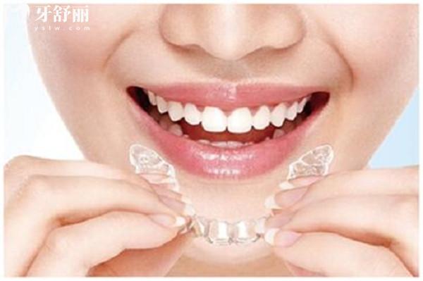 重庆城口牙科医院收费标准